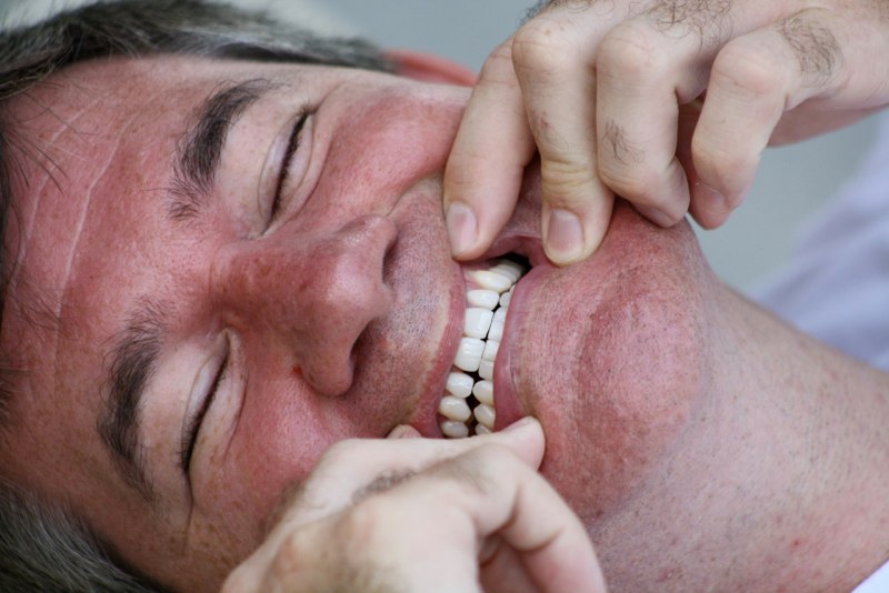 After..sparkling white teeth