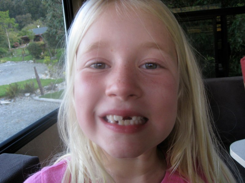 Lost a tooth